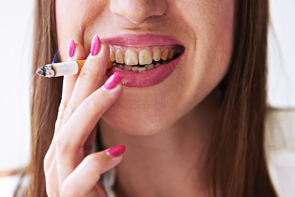 Grafika wyróżniająca artykułu: Wpływ palenia papierosów na zęby – od żółtych zębów po choroby przyzębia